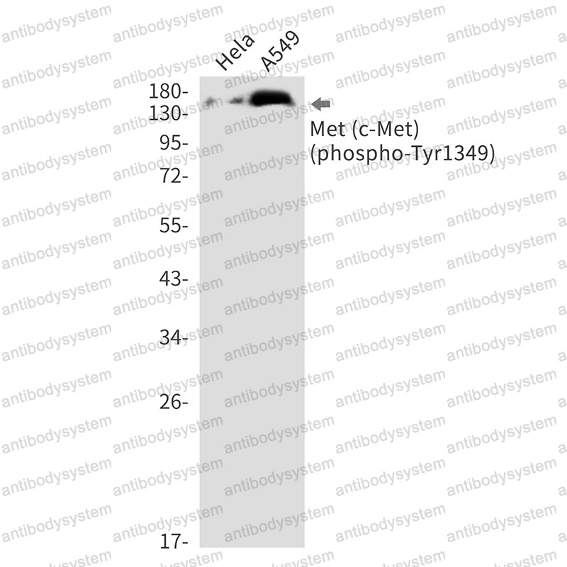 Anti-Phospho-MET/c-Met/HGFR (Tyr1349) Antibody (R1L69)