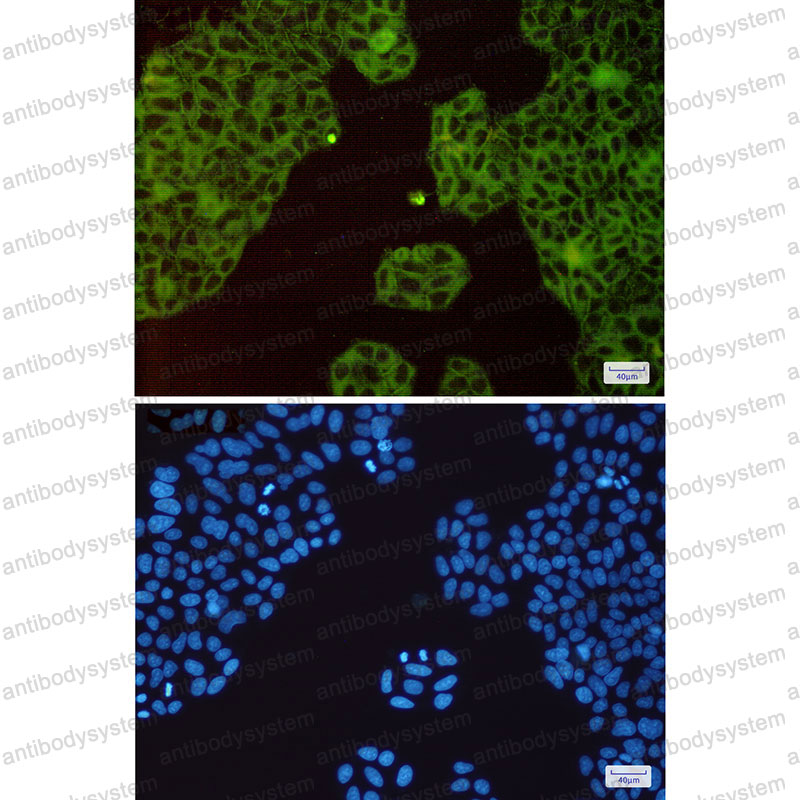 Anti-MET/c-Met/HGFR Antibody (R1L70)