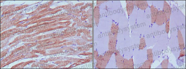 Anti-MYL3 Antibody (R3B11)
