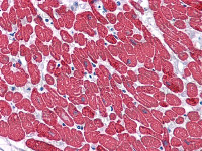 Anti-MYL3 Antibody (R3B10)