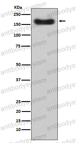 Anti-CFH Antibody (R1L71)
