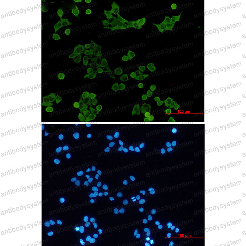 Anti-HCK Antibody (R1L72)