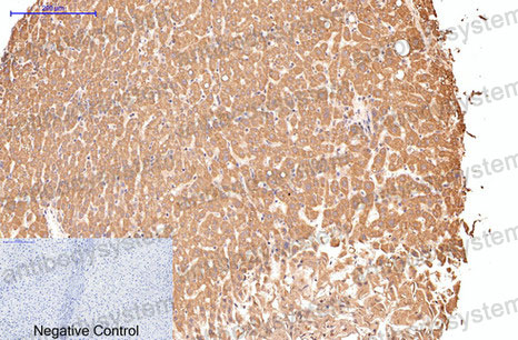 Anti-CD16a/FCGR3A Antibody (R3B14)