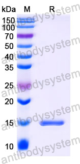 Anti-Human VIM/Vimentin Nanobody (SAA1226)