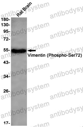 Anti-Phospho-VIM/Vimentin (Ser72) Antibody (R1L75)