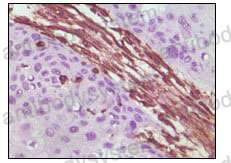 Anti-VIM/Vimentin Antibody (R3B19)