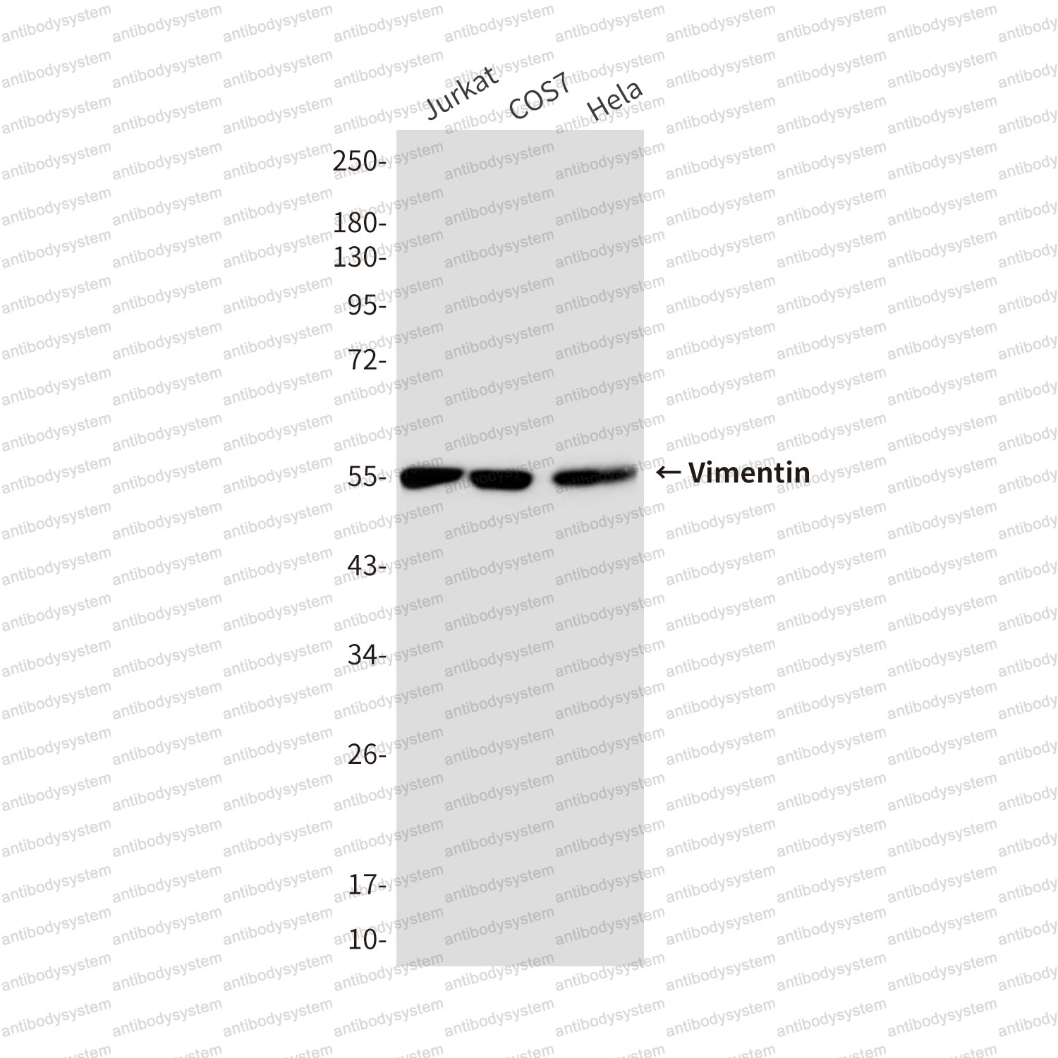 Anti-VIM/Vimentin Antibody (R3B22)