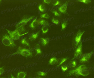 Anti-VIM/Vimentin Antibody (R3B23)