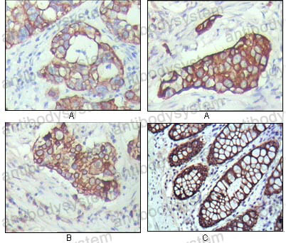 Anti-KRT19/CK19 Antibody (R3B27)