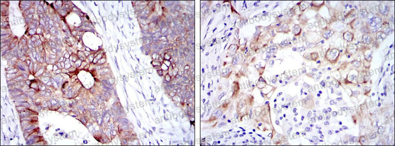 Anti-KRT19/CK19 Antibody (R3B28)
