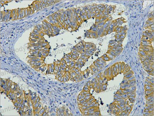 Anti-KRT19/CK19 Antibody (R3B33)