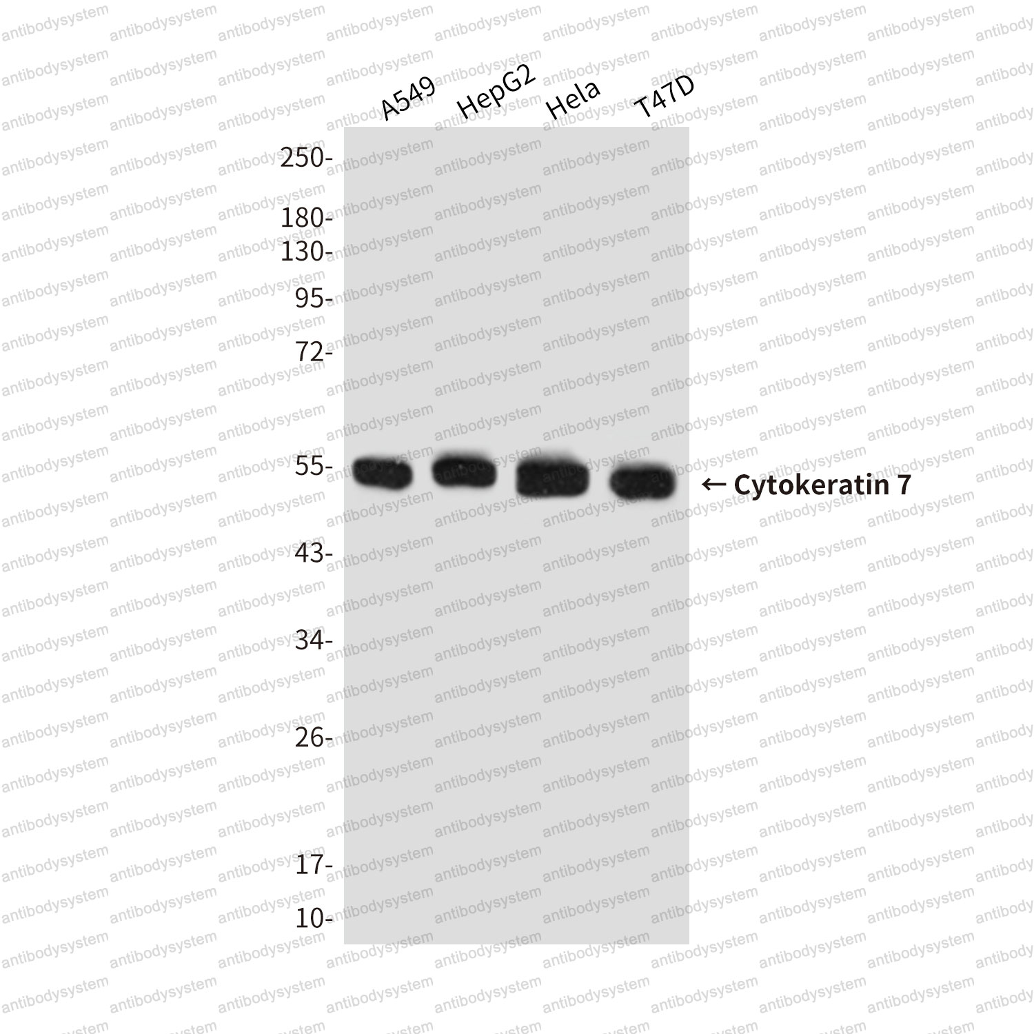 Anti-KRT7 Antibody (R3B36)