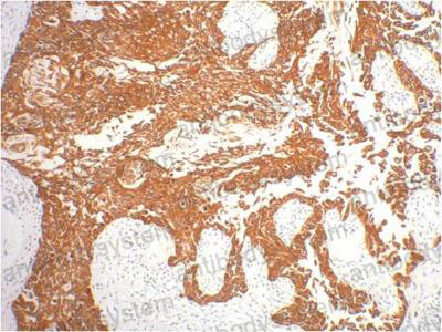 Anti-KRT16 Antibody (R3B39)