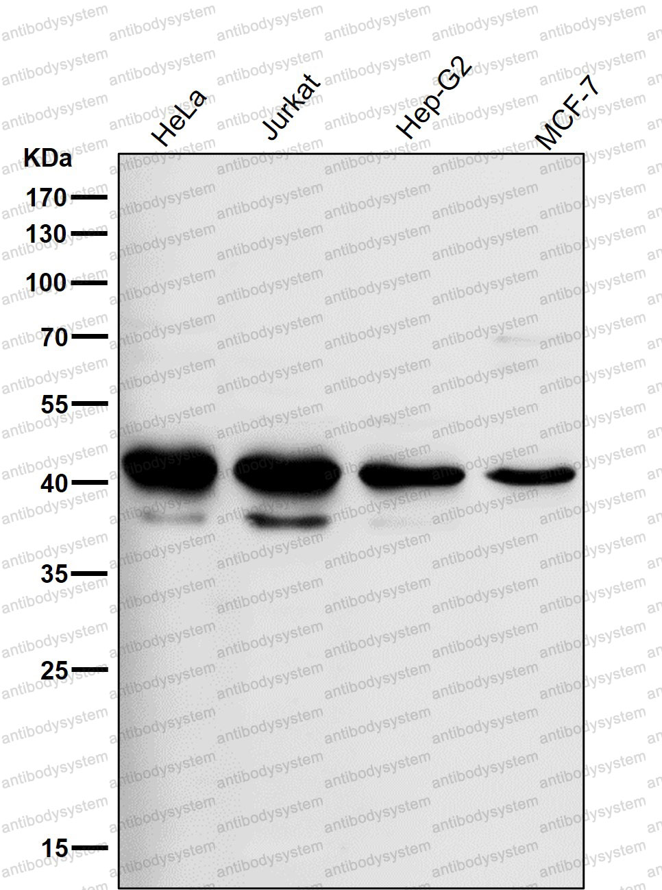 Western blot for Anti-RPSA Antibody (R1L85) ?>