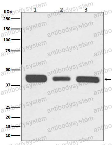 Western blot for Anti-RPSA Antibody (R1L85) ?>