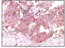 Anti-FGF2/FGFb Antibody (R3B46)