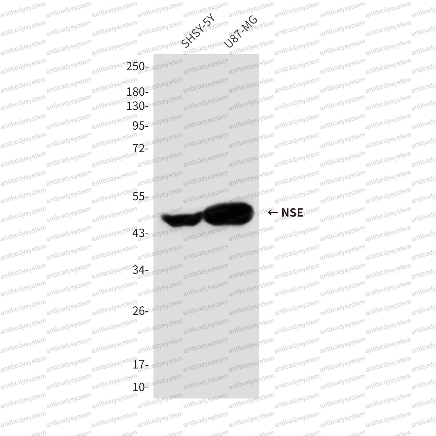 Anti-ENO2/NSE Antibody (R3B51)
