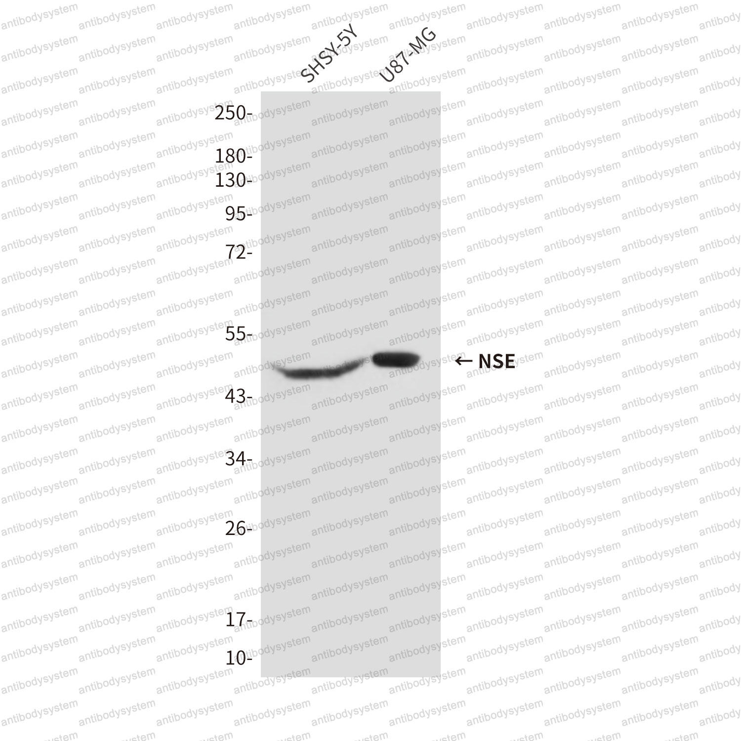 Anti-ENO2/NSE Antibody (R3B52)