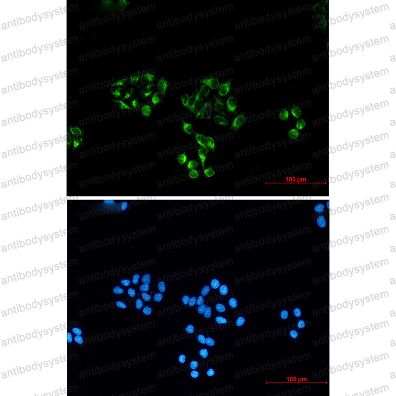 Anti-ENO2/NSE Antibody (R3B53)