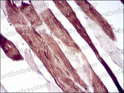 Anti-VIL1 Antibody (R3B57)