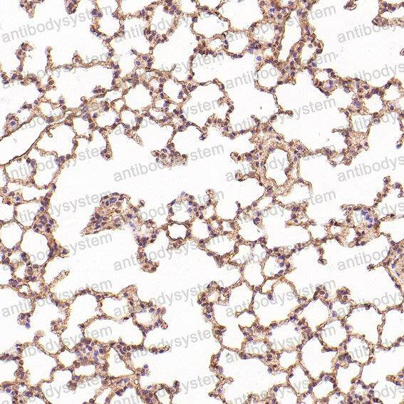 Anti-HMGB1 Antibody (R1A30)