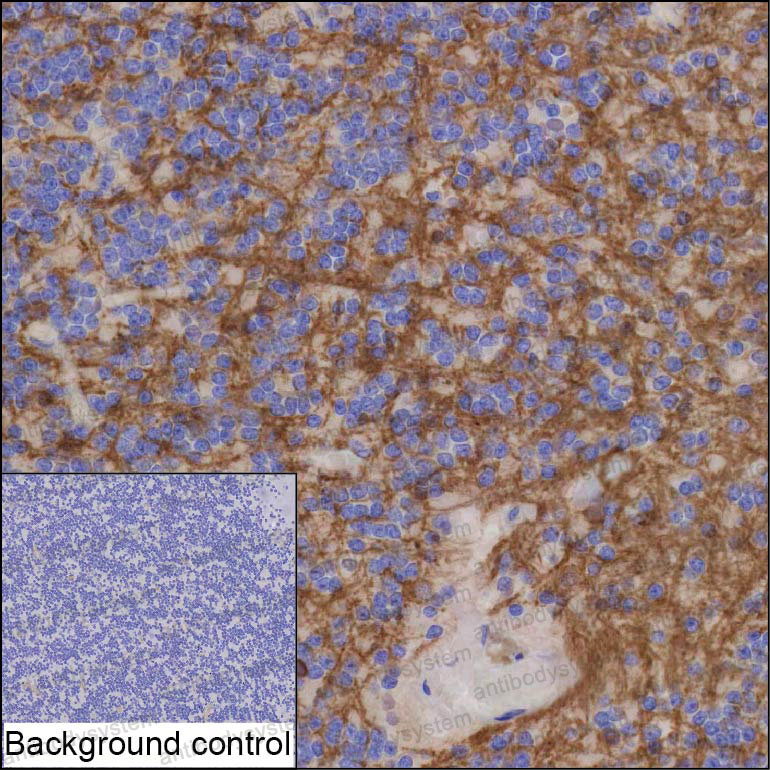 Anti-CNP Antibody (R3B62)