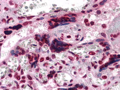 Anti-CSF1/M-CSF Antibody (R3B69)