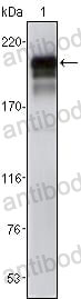 Anti-CD140b/PDGFRB Antibody (R3B70)