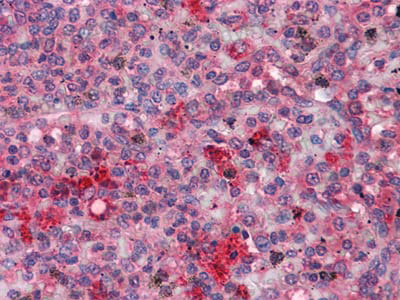 Anti-FGR Antibody (R3B75)