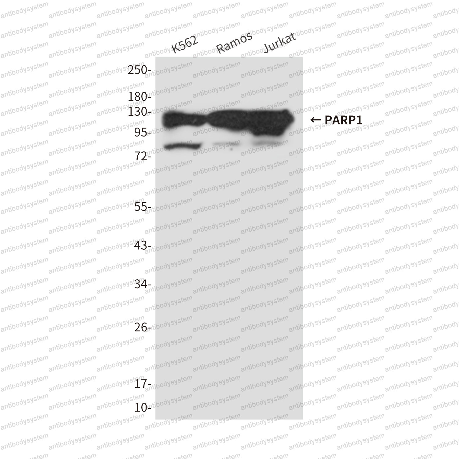 Anti-PARP1 Antibody (R3B77)