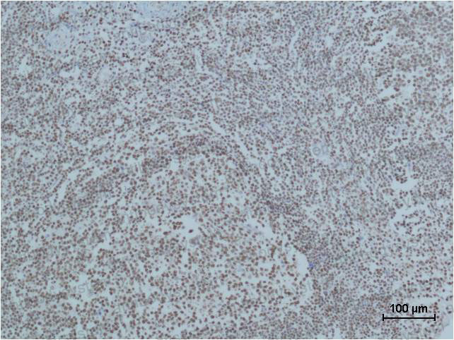 Anti-PARP1 Antibody (R3B78)