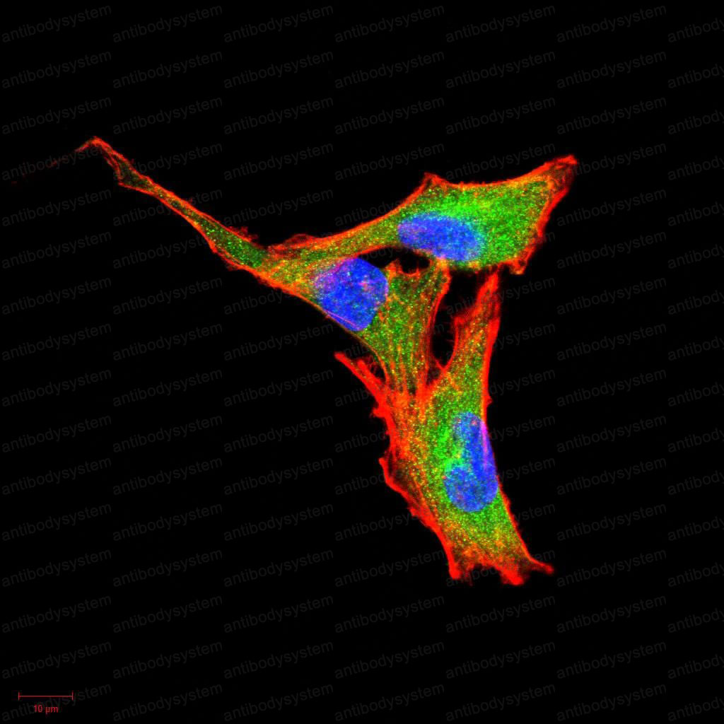 Anti-CSF3/G-CSF Antibody (R3B79)