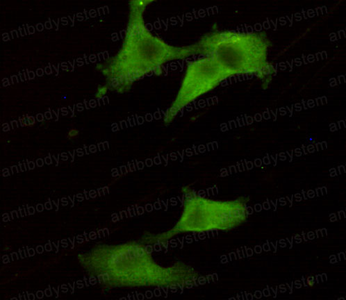 Anti-UCHL1 Antibody (R3B84)