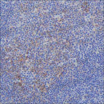 Anti-C4A Antibody (R3B85)