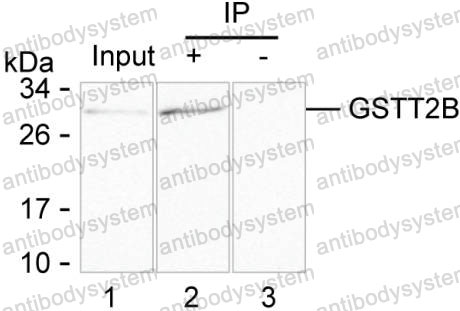 Anti-GSTT2B Antibody (R3B88)