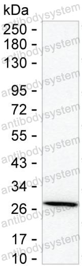 Anti-GSTT2B Antibody (R3B87)