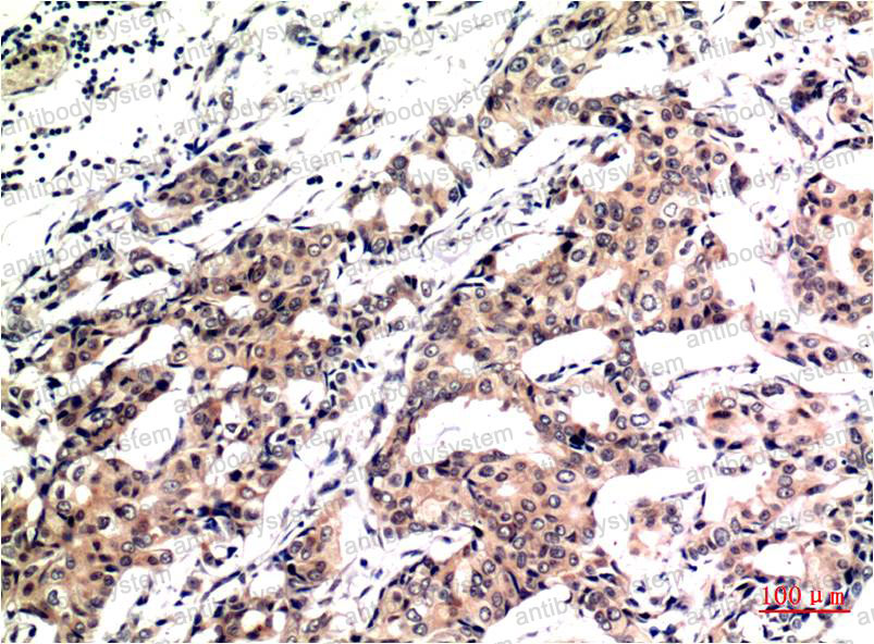Anti-UBB Antibody (R3B90)