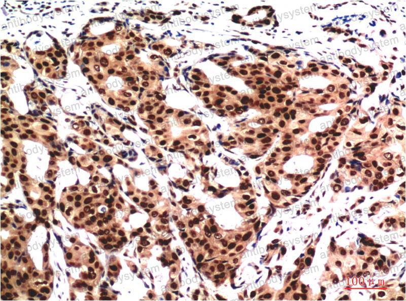 Anti-UBB Antibody (R3B91)