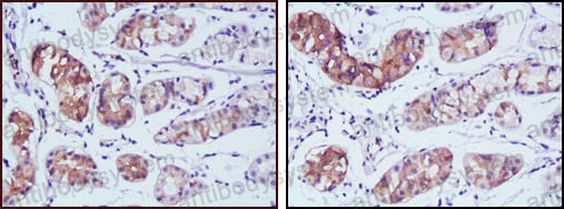 Anti-PGA5 Antibody (R3B93)