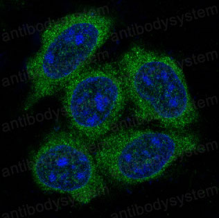 Anti-HSPA1A/B Antibody (R1C19)