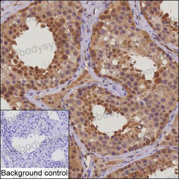 Anti-HSPA1A Antibody (R3B95)