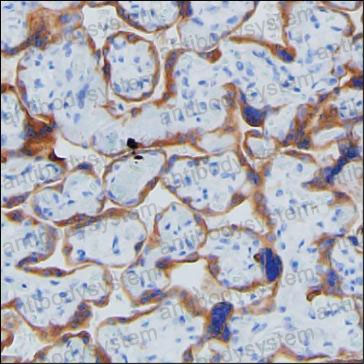 Anti-CGB3/CGB Antibody (R3B97)