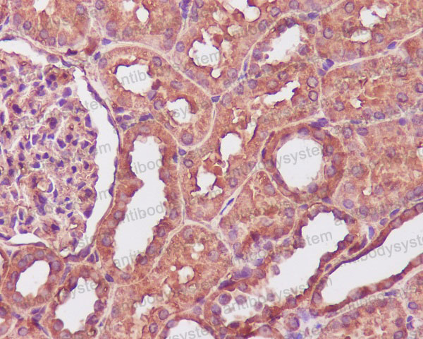 Anti-CALM1 Antibody (R1A96)