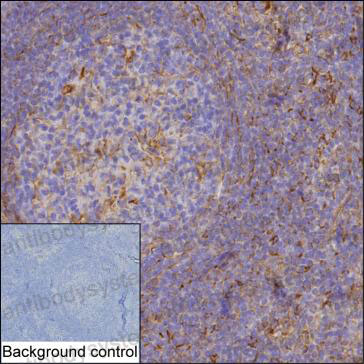Anti-CCL3/MIP-1-alpha Antibody (R3C03)