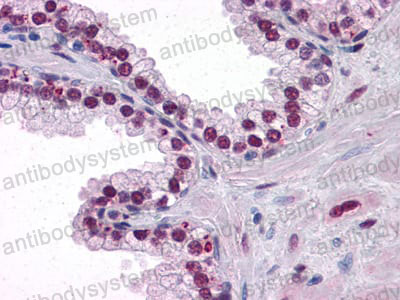 Anti-AR Antibody (R3C04)