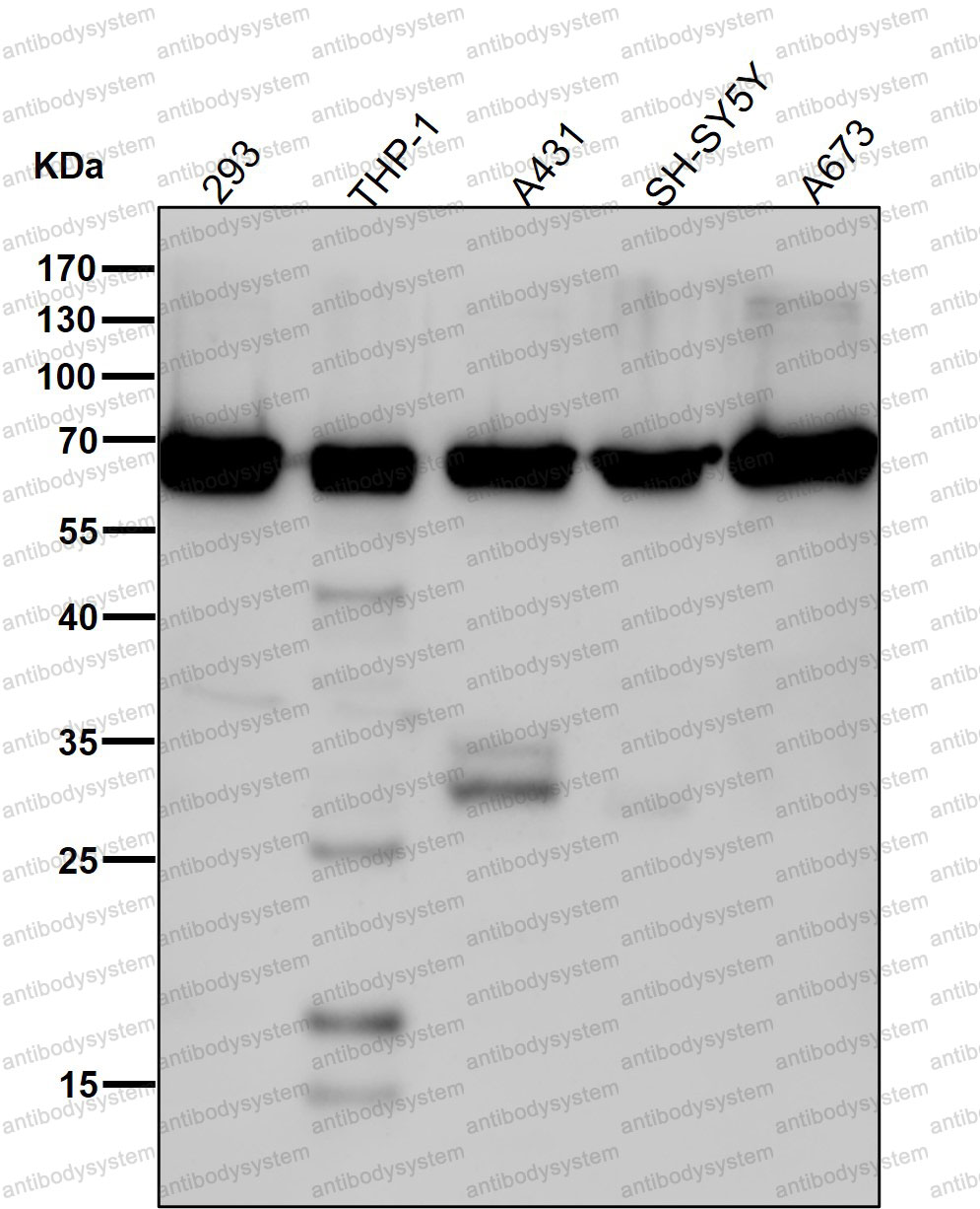 Western blot for Anti-DLAT/PDC-E2 Antibody (R1M68) ?>