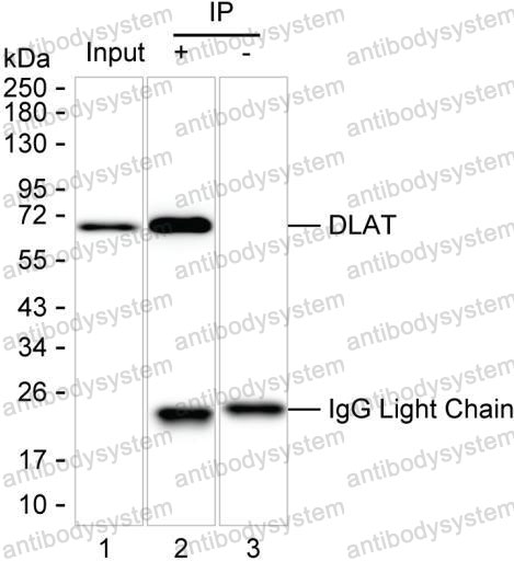 Anti-DLAT/PDC-E2 Antibody (R3C14)