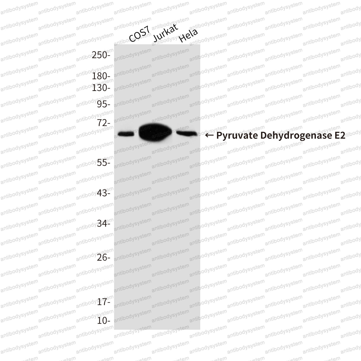 Anti-DLAT/PDC-E2 Antibody (R3C15)