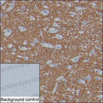 Anti-MAPT/Tau/PHF-tau Antibody (R3C17)