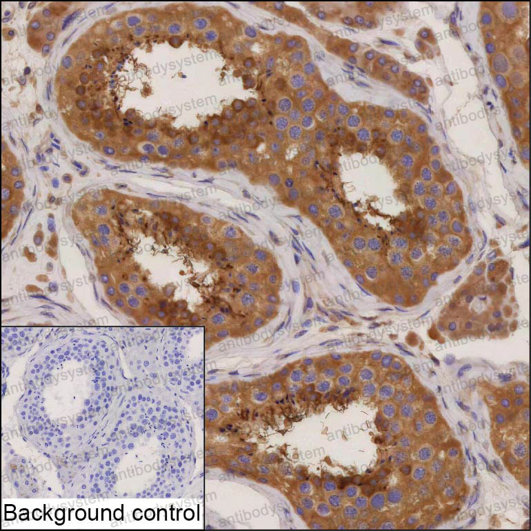 Anti-PRKAR1A Antibody (R3C18)